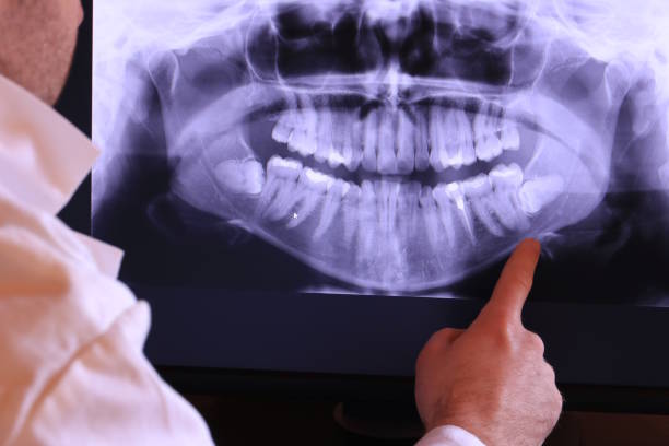 Best Emergency Root Canal Treatment in Laurel, DE